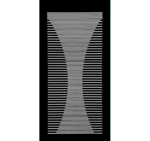 TTE - AM 02